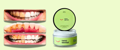 Nexo Dental Approved Teeth Whitening Powder
