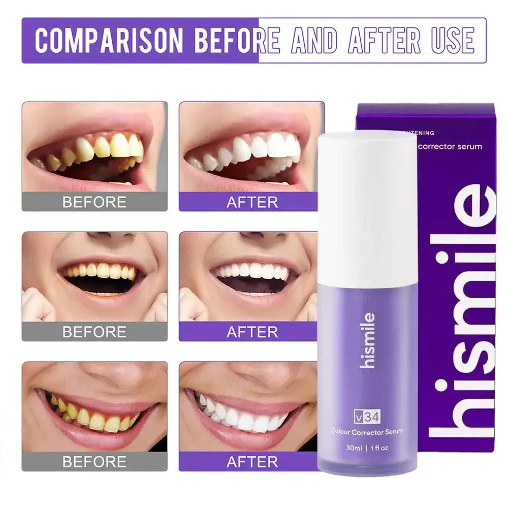 Hismile v34 Colour Corrector Serum Purple Teeth Whitening