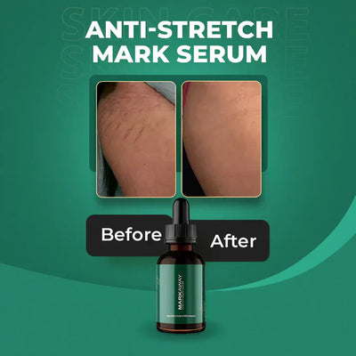 Stretch Mark Serum