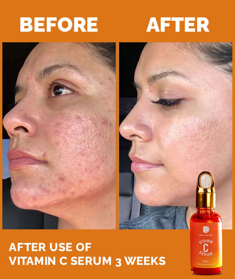 Vitamin C Serum