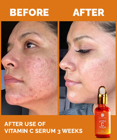 Vitamin C Serum